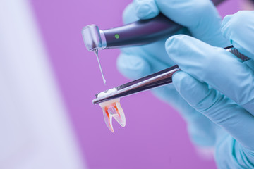 Dental model of realistic tooth with dental drill above