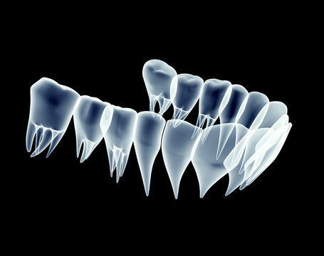 x-ray image of teeth isolated on black