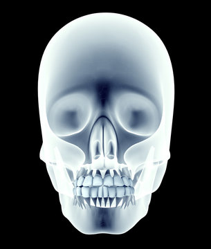 x-ray image of a skull with teeth