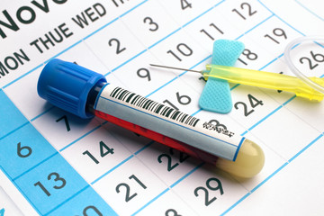 blood tube and needle over a appointment calendar in workbench of lab / blood sample tube and...