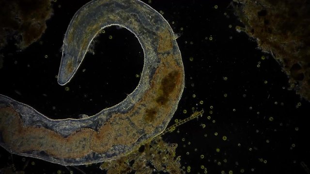 Wurm im Mikroskop - 1080p Full HD