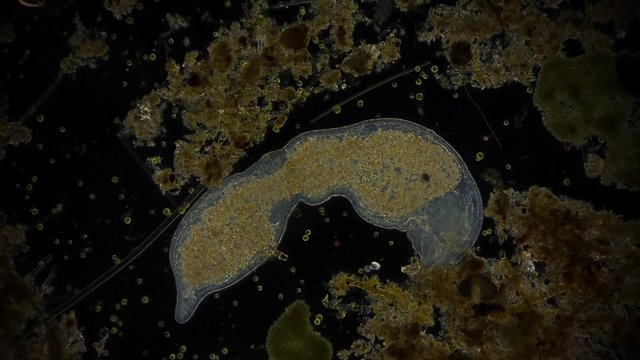 Mikroorganismus im Mikroskop - 1080p Full HD