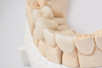 Fototapeta na wymiar ceramic crowns in dental laboratory