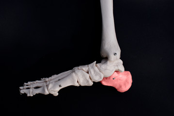 Calcaneus 