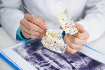 Teeth inspection. Health care. Woman doctor analyzing tooth caries on teeth model and x-ray. 