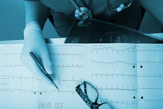 Medical experts are studying the ECG condition of the patient