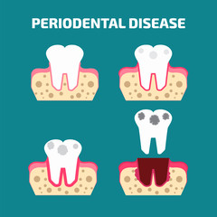 Periodontal disease icons set