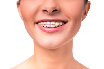 Obraz premium Woman with braces