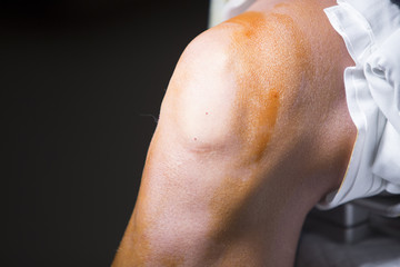 Traumatology orthopedic surgery knee arthroscopy