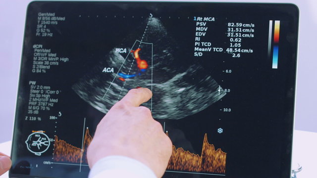 male hand analyzing a sonogram on computer