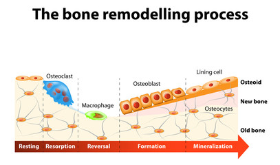 bone remodelling process
