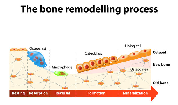 bone remodelling process