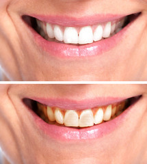 Naklejka premium Healthy woman teeth.