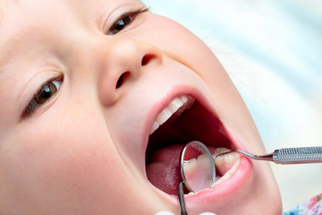 Child having dental examination.