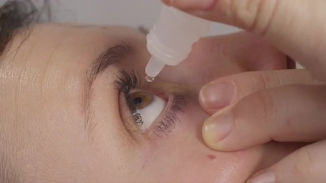 CLOSE UP: Woman drops an eyedrop into her eye