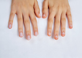 woman hands with nails before treatment