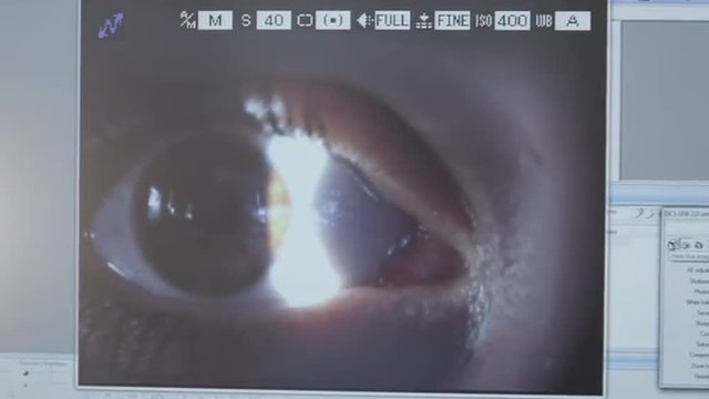MACRO: Checking an eye with the light