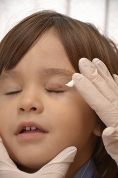 child with stye on eye, treatment with lubricants