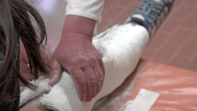 Removing plaster cast from child leg. Medical 