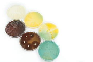 Petri dishes with bacterial colonies on white background