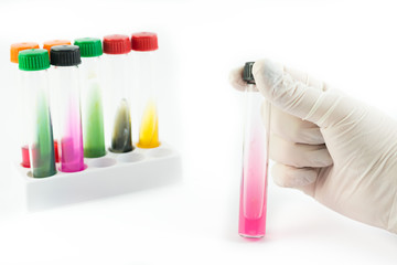 Laboratory doctor hands with sterile gloves holding laboratory test tubes infected with different bacteria isolated on white background