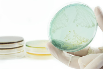 Hand in glove holding petri dish with bacteria growing on it isolated on white background. Medical tests and research. Bacterial cultures in laboratory glassware