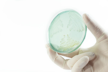 Hand with gloves holding petri dish with bacterial colonies. Isolated on white background