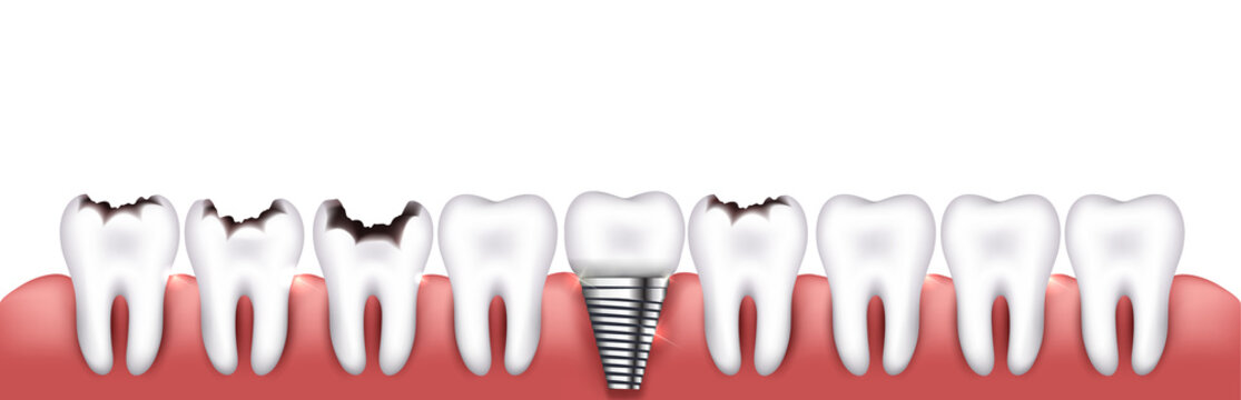 Various teeth conditions
