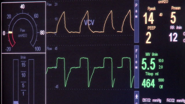 heart monitor in hospital ER