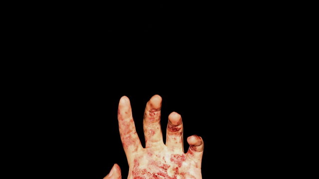 Blutige Hand