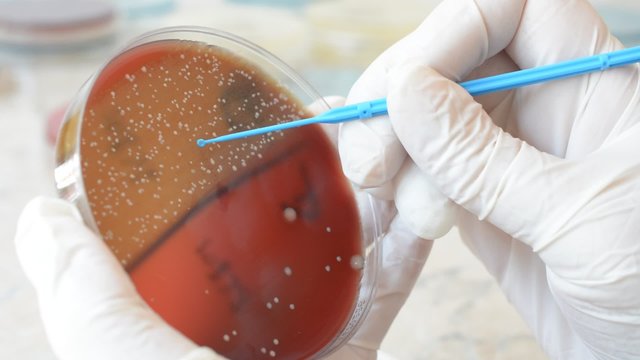 Laboratory doctor hands with sterile gloves using inoculation loop to isolate Staphylococcus bacteria from blood agar infected this bacteria. Medical laboratory concept
