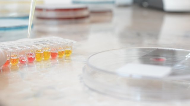 Laboratory doctor or scientific researcher using a pipette to take samples of infected urine with ureaplasma bacteria