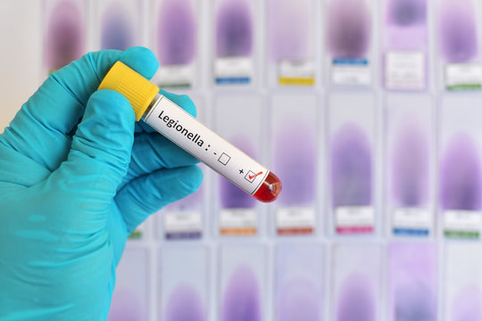 Legionella blood sample
