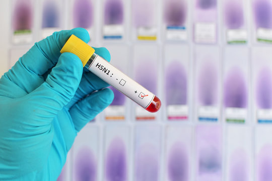 H5N1 blood sample