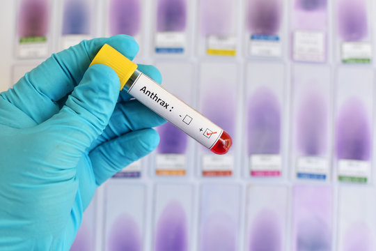 Anthrax blood sample