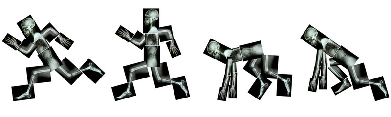 human bone is running. (step of run a race),(Whole body : head neck spine back shoulder arm elbow...