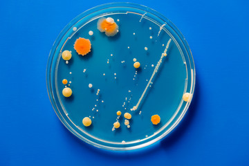 Bacteria colonies on petri dishes  on blue