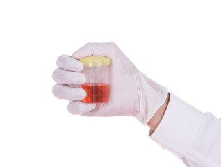 doctor's hand in gloves holding a transparent container with the