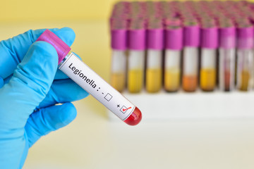 Legionella positive blood sample