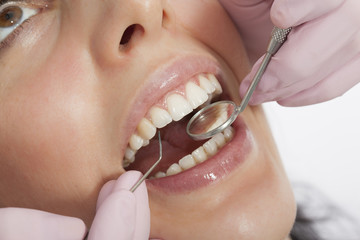 Dentist examining a patient's teeth in the dentist.