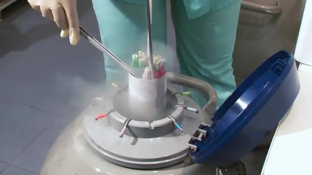Fertility doctor with a microscope, a syringe and petri dish fertilization of eggs and research in reproduction clinics. Storing frozen eggs and sperm in a box filled with liquid nitrogen.