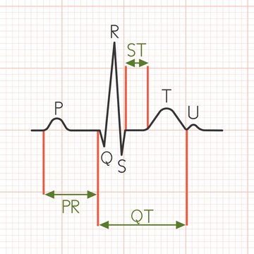 Vector cardiogram,flat design