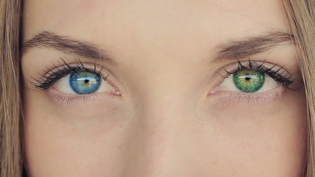 Woman With Blue And Green Eyes- Heterochromia