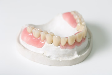 Fototapeta na wymiar Zahnprothese im zahntechnischen Labor