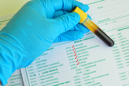 Blood sample for special chemistry testing
