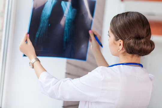 Female doctor looking at x-ray image
