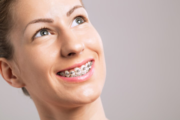 Naklejka premium Braces Teeth Female Smile