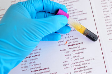 Blood sample for lead testing
