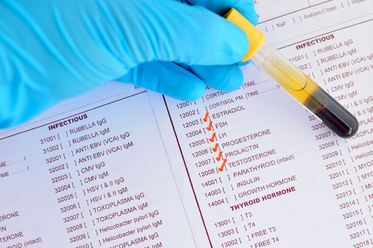 Blood Sample For Sex Hormone Testing