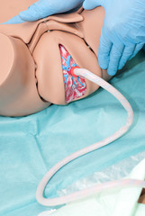 childbirth